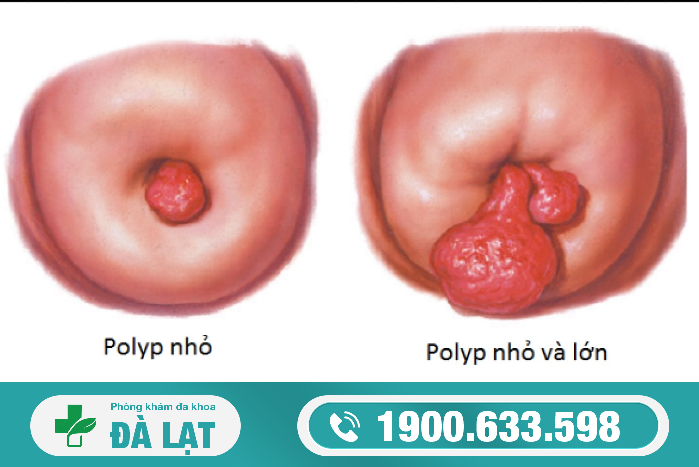 Hình ảnh minh họa